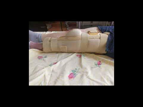 22.09.23г. Виктор. Ортез и тутор на руку. Тутор на ногу первый раз, в ...