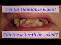 Magic Dentistry - Time lapse video