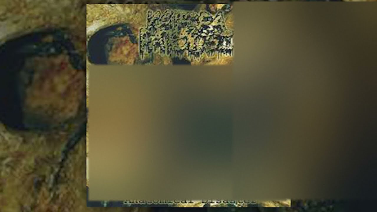 Katedra Patologii - Anatomical Disaster FULL ALBUM (2004 - Goregrind)