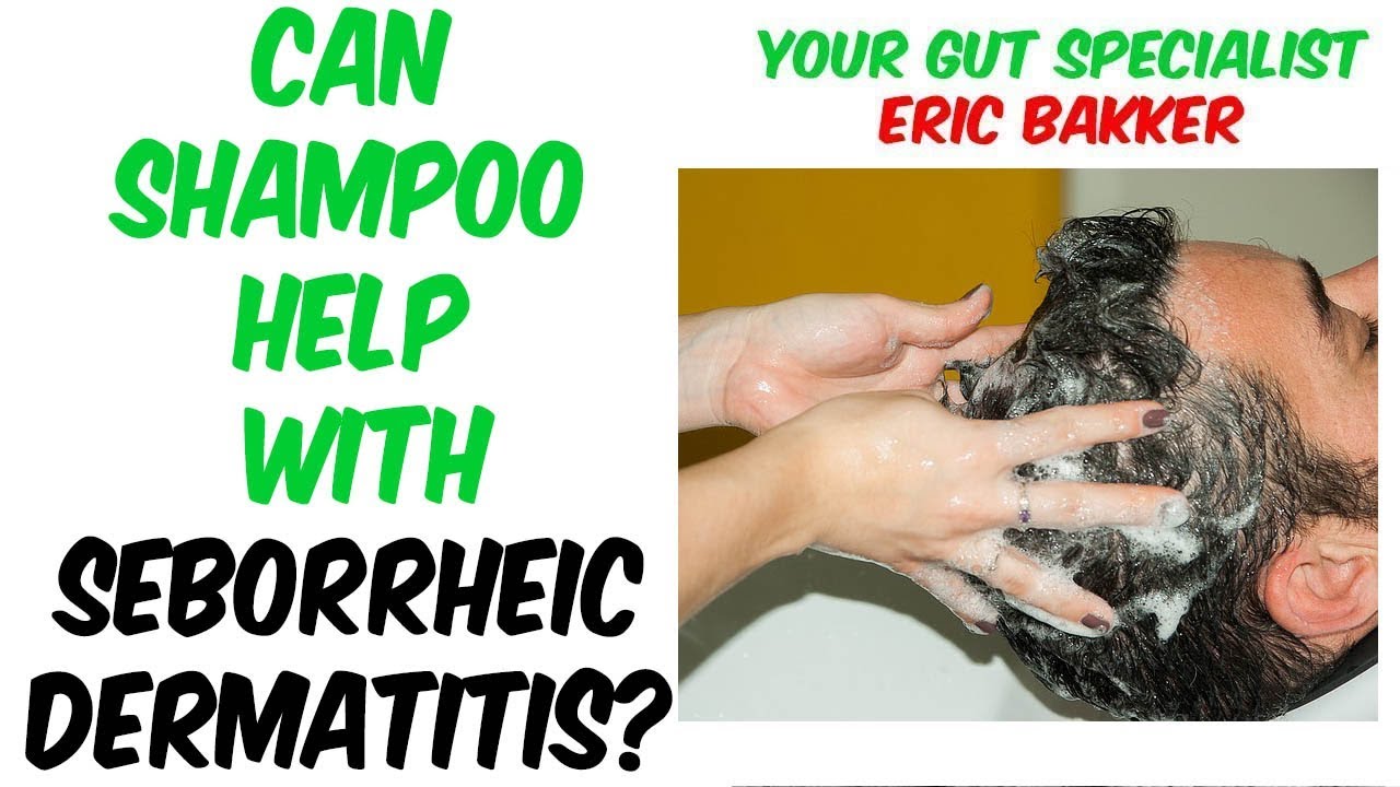 Can Shampoo Help With Seborrheic Dermatitis? 