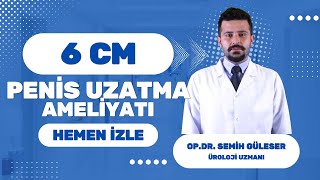 6 CM Penis Uzatma Ameliyatı; Op  Dr  Semih Güleser
