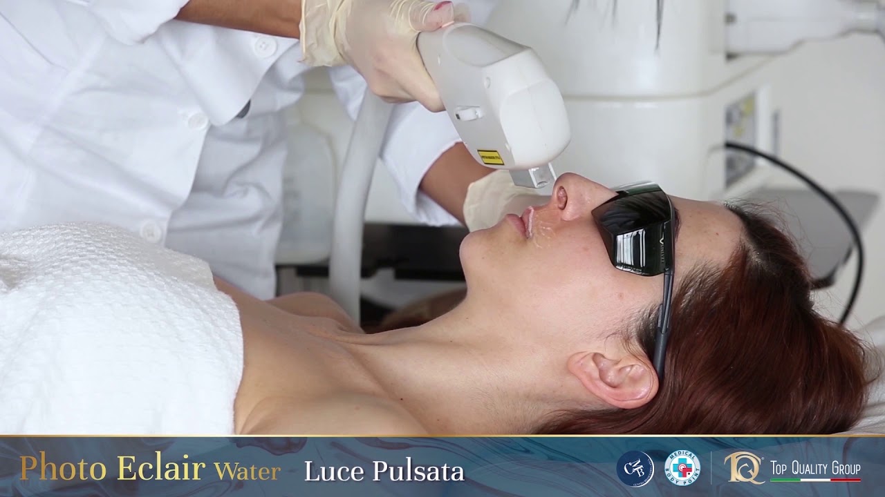 Trattamento Photo Eclaire - luce pulsata viso