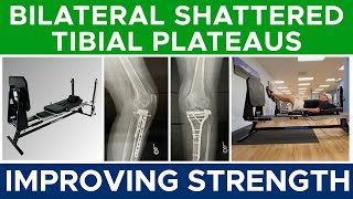 Bilateral Tibial Plateau Fractures: Improving Leg Strength & Knee Stability | Return to Jumping