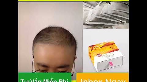 Hói Đầu - Lừa Đảo?| Alette - Túi Lọc Gội Đầu Detox |Trị Rụng Tóc - Giúp Mọc Tóc Nhanh - Dày - Khỏe