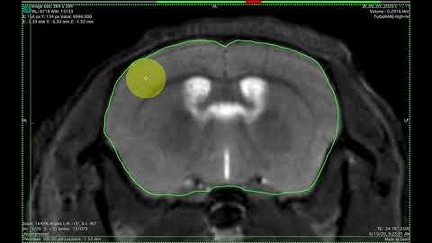 OsiriX Software Overview