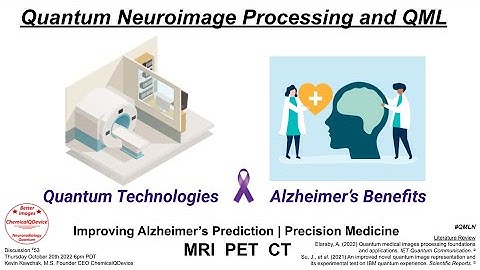 Quantum Neuroimage Processing and QML for Alzheimer
