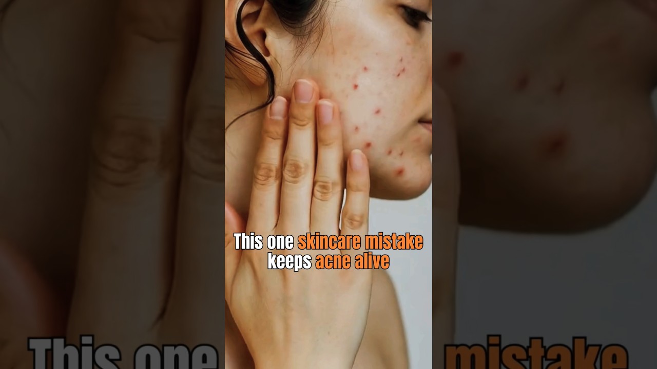 Why Vedalth Multani Mitti Soap Is Perfect for Acne #shorts