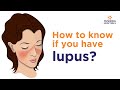 Systemic Lupus Erythematosus (SLE): Symptoms, Diagnose And Treatment | Rheumatology