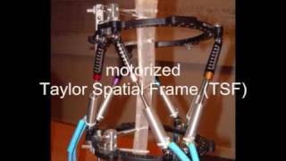 Taylor Spatial Frame (TSF) - Motorised  Ilizarov alternative, Hexapod - Orthopaedic ring fixator