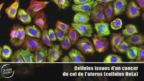 "C'est quoi la chimiothérapie ?", avec Karin Tarte
