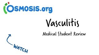 Vasculitis | Clinical Presentation