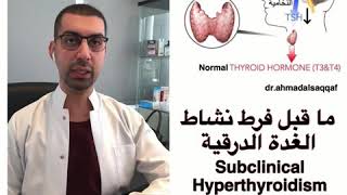 دكتور أحمد السقاف Dr.Ahmad Alsaqqaf/ ما قبل فرط نشاط الغدة الدرقية  Subclinical Hyperthyroidism