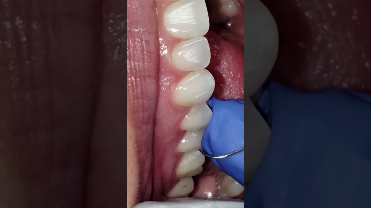 11/12 Explorer Demo Video YouTube