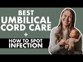 HOW TO TAKE CARE OF NEWBORN BELLY BUTTON | Umbilical Cord Care | Infected Umbilical Cord