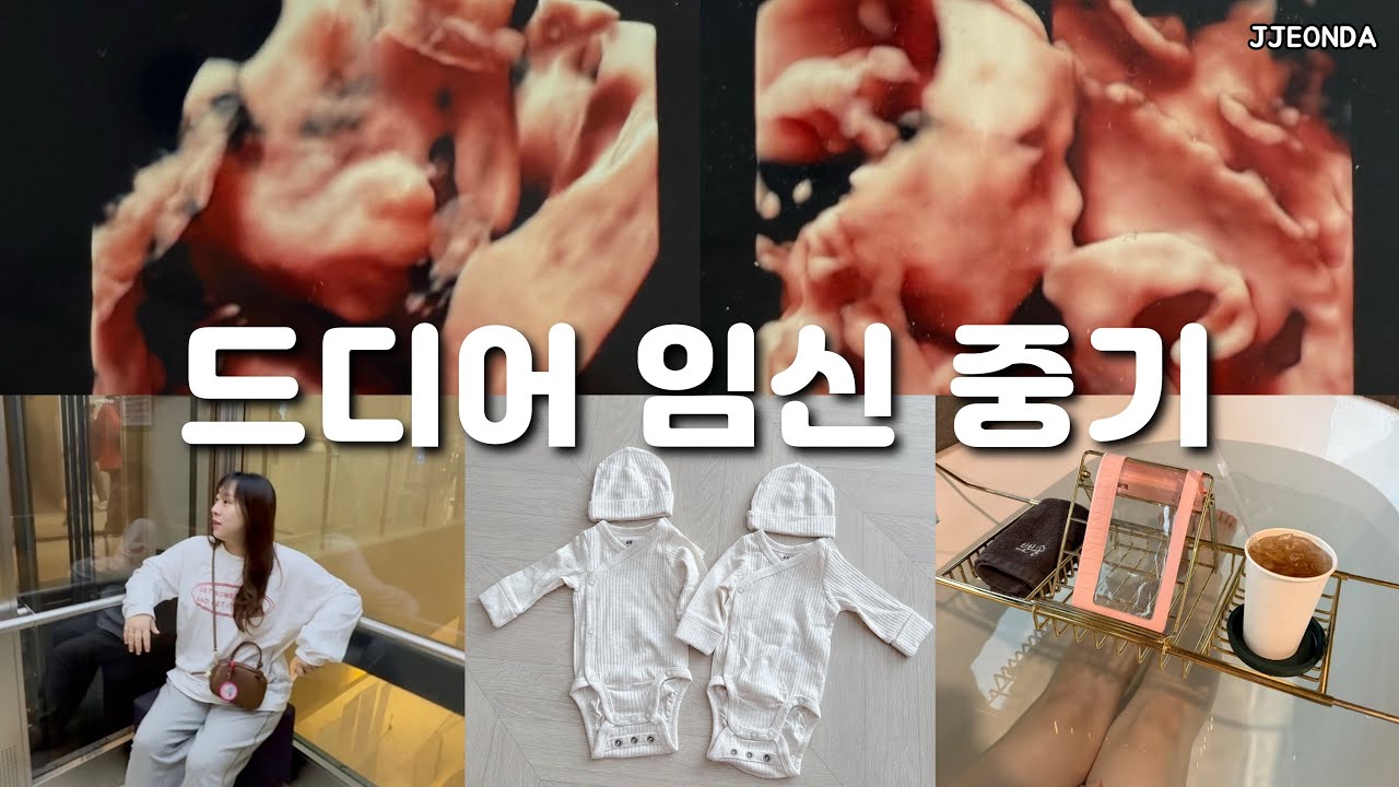 Видеоблог о беременности | 19 недель беременности двойней, наполненной счастьем, небольшой день и...