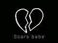 scars babe remix