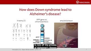 NADRC Webinar: Innovative Approaches to Supporting Pro Caregivers Of People Living w/IDD & ADRD