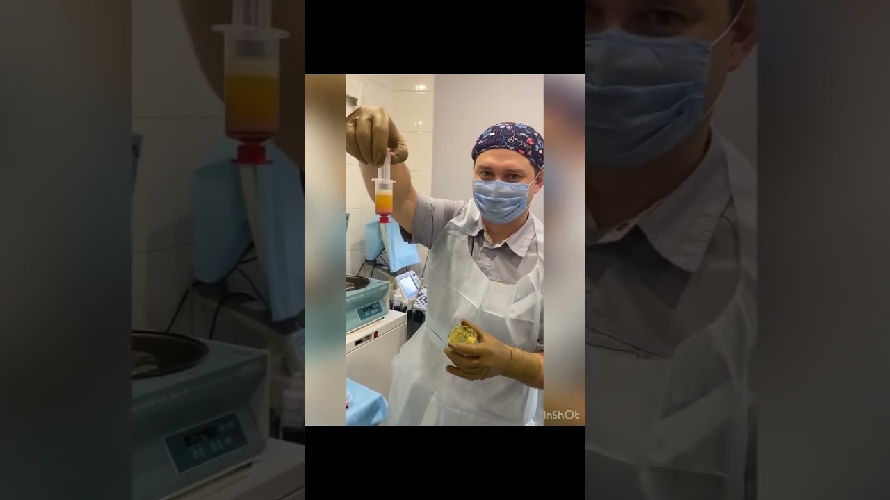 Лечение суставов без операции! #svf #acpsvf #стромальноваскулярнаяфракция #лечениесуставов #артроз