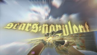 scars // cs2 montage