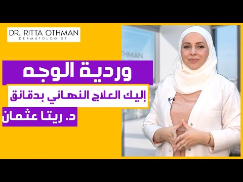 وردية الوجه | طفح الفراشة | دكتورة ريتا عثمان