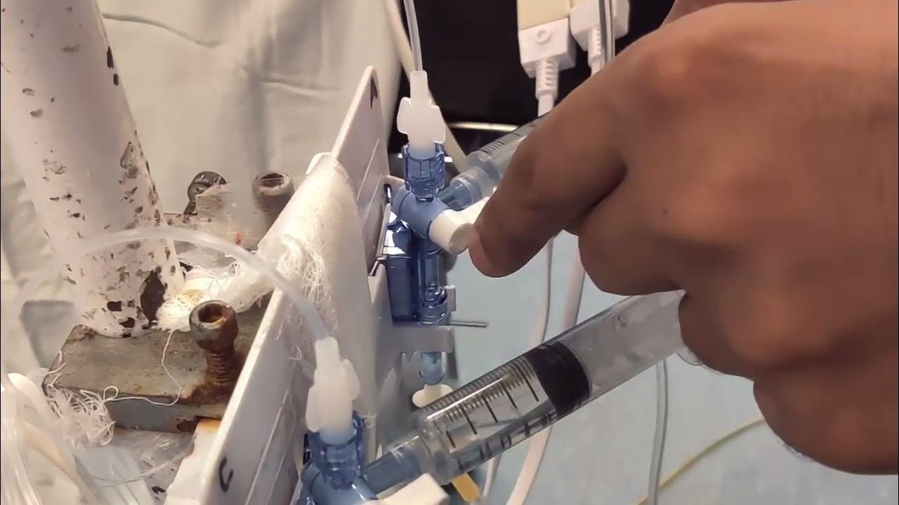 How to setup A line and CVP line transducer in operation Theater by MWM