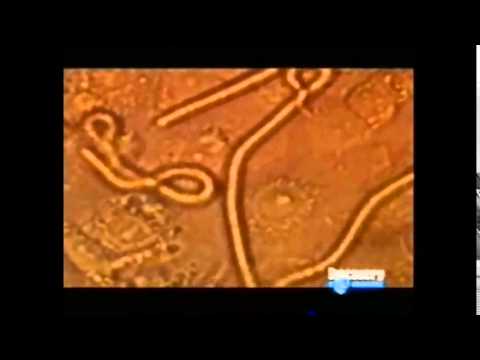 Filacio Trabalho Filariose - IBAO - YouTube