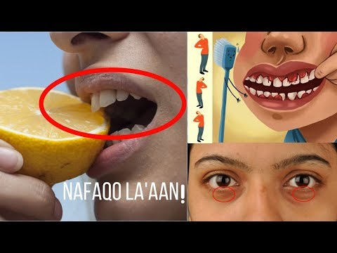 5 CALAAMADOD OO KU OGAAN KARTO INAAD NAFAQO LA&rsquo;AAN TAHAY |LAMAYAQAAN #NAFAQO