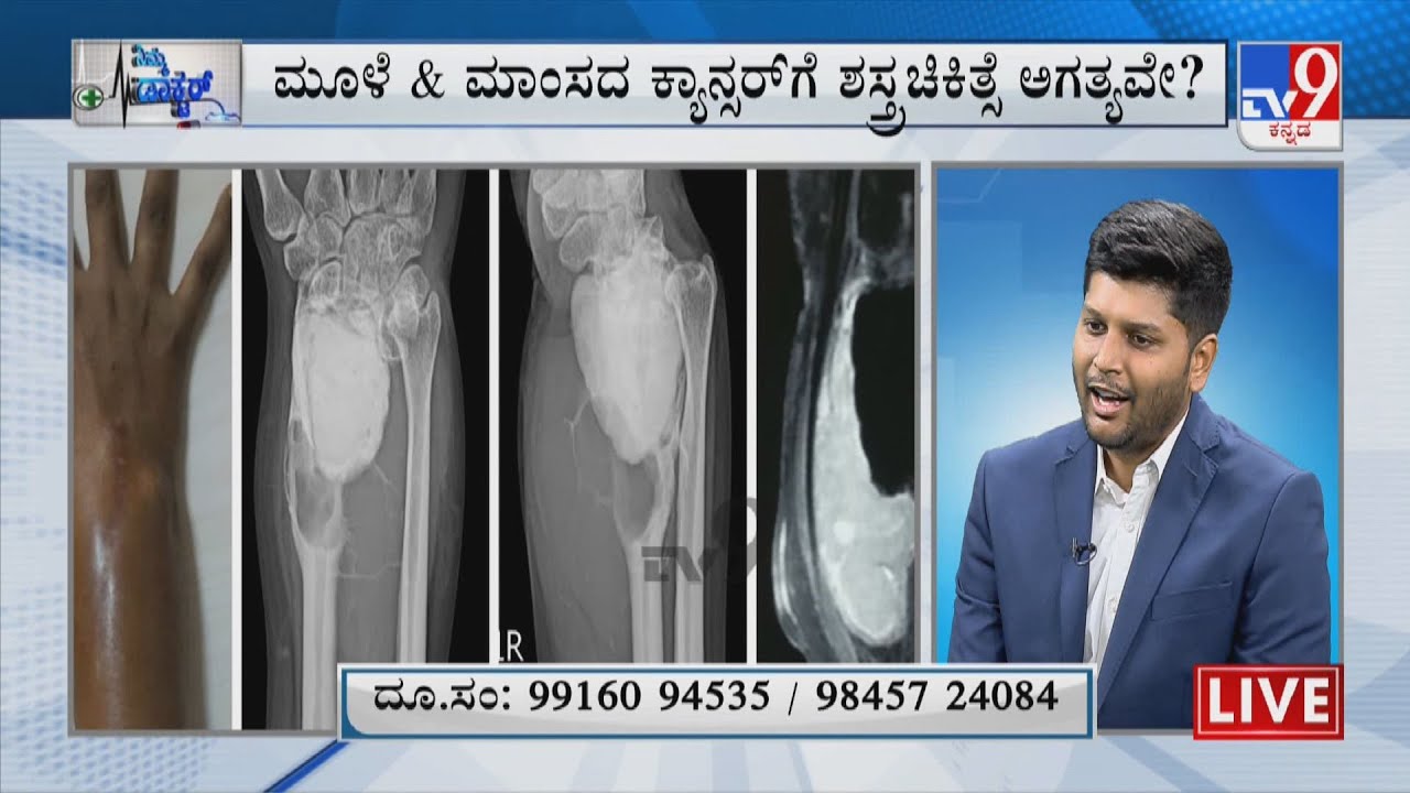 Nimma Doctor | Treatment For Bone And Soft Tissue Cancer | Apollo Cancer Centres (28-04-2022)