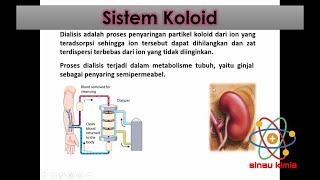 Koloid | KIMIA KELAS 11