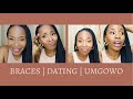 I WISH I KNEW THIS WAAAAY BEFORE | BRACES JOURNEY | South African Youtuber in China