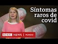 4 extraños síntomas del covid-19 de los que quizás no hayas oído hablar | BBC Mundo