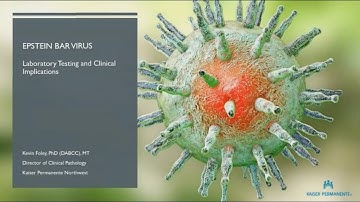 EBV Testing: A Laboratory Perspective