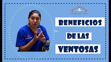 ¿Cuáles son los beneficios de las ventosas?