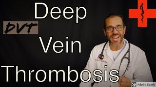 Deep Vein Thrombosis -  a patient education video by Dr. Carlo Oller