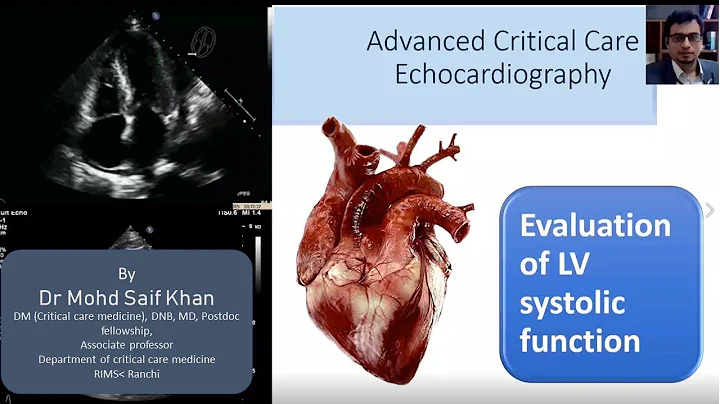 Evaluation of LV systolic functions in ICU #cardiology #mrcp #edic #neet #md #mbbs #emergency #dnb