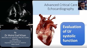 Evaluation of LV systolic functions in ICU #cardiology #mrcp #edic #neet #md #mbbs #emergency #dnb