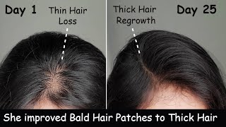 25 Days Diet for Hair Loss | Food for Hair Growth - Thin Hair to Thick Hair | Hair Regrowth screenshot 3