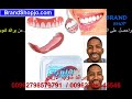 بيرفكت سمايل ابتسامة هوليود قشرة و طقم اسنان علوي بيرفكت سمايل قابلة للازالة اسنان في لحظات Perfect بيرفكت سمايل ابتسامة هوليود قشرة و طقم اسنان علوي بيرفكت سمايل قابلة للازالة اسنان في لحظات Perfect