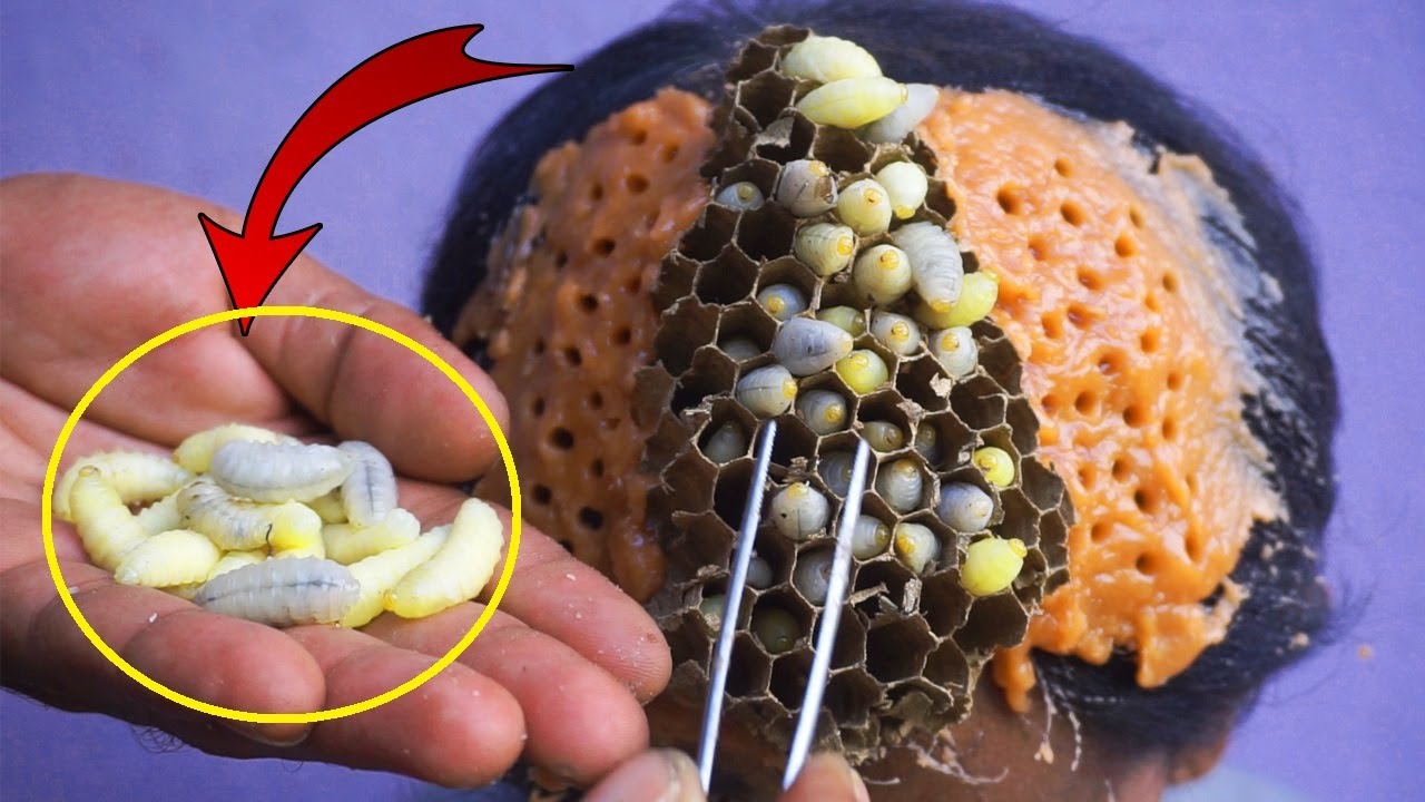 Top 2 Videos Of Dandruff Biggest Wasp Babies Extraction #1054 - YouTube