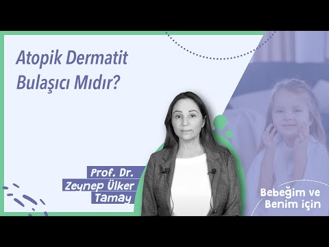 Atopik Dermatit (Egzama) Bulaşıcı Mıdır?