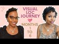 Visual Loc Journey | Sisterlocks | Months 1 to 6