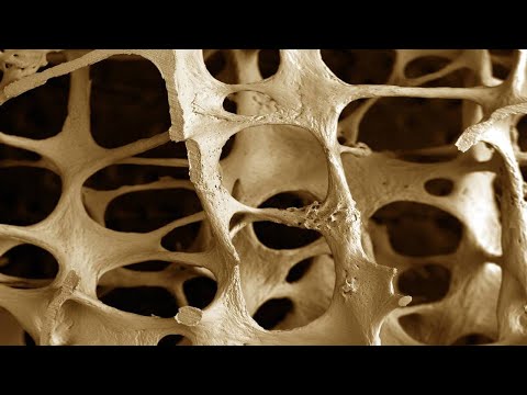 THIS COMMON DRINK DESTROYS YOUR BONES AND IS FULL OF CHEMICALS!