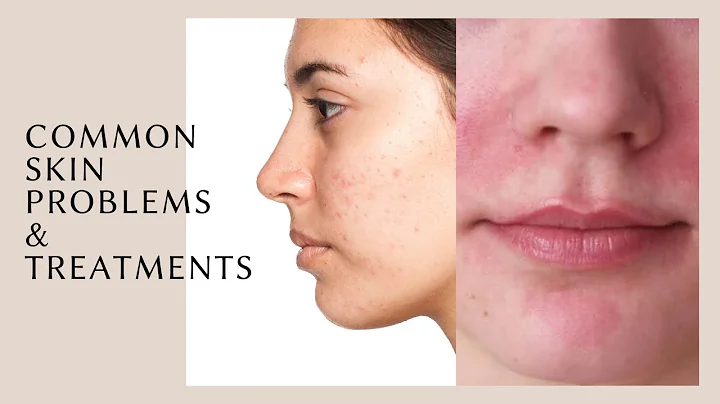 TUTORIAL  Common Skin Problems You'll See as an Es...