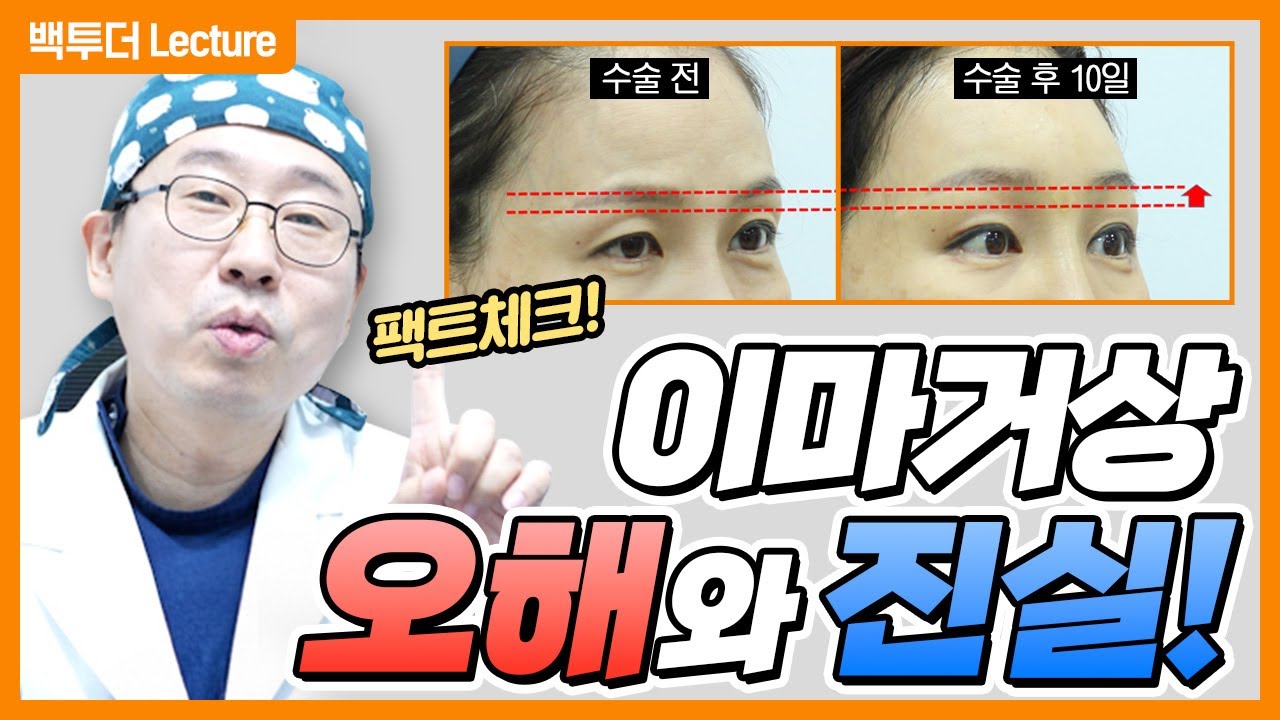 눈과 이마를 한 번에? 이마거상의 오해와 진실 총정리!