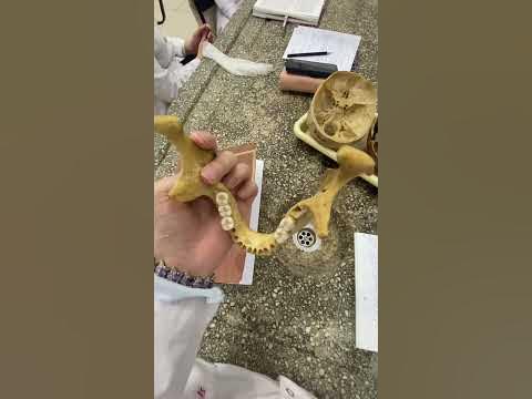 Нижняя челюсть. Кости черепа. Анатомия. - YouTube