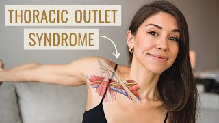 Thoracic Outlet Syndrome Exercises (HOW TO FIX IT!)  Causes, Symptoms & Treatment.