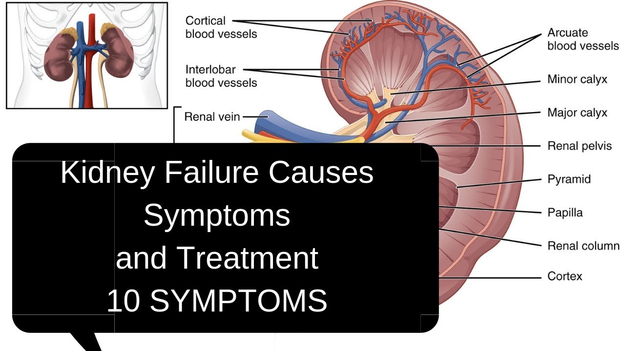 a short essay on kidney failure