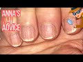 How To Care For Ridgy Nails  [ANNA'S NAIL ADVICE] 🕵️‍♀️