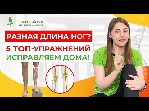 ИСПРАВЛЯЕМ РАЗНУЮ ДЛИНУ НОГ. Простые упражнения. Кинезитерапия