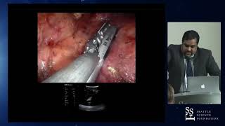 Reducing Warm Ischemia Time During Robotic Partial Nephrectomy presented by Keban Badani, MD